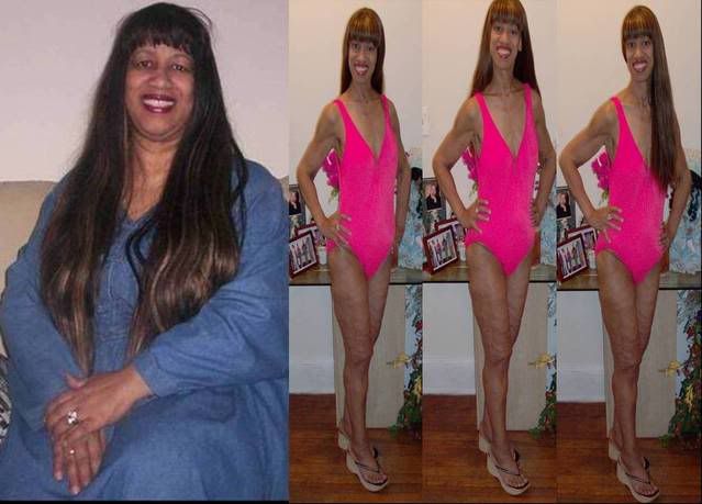 martita17monthsurgiversary-swimsuit.jpg picture by martitalinda